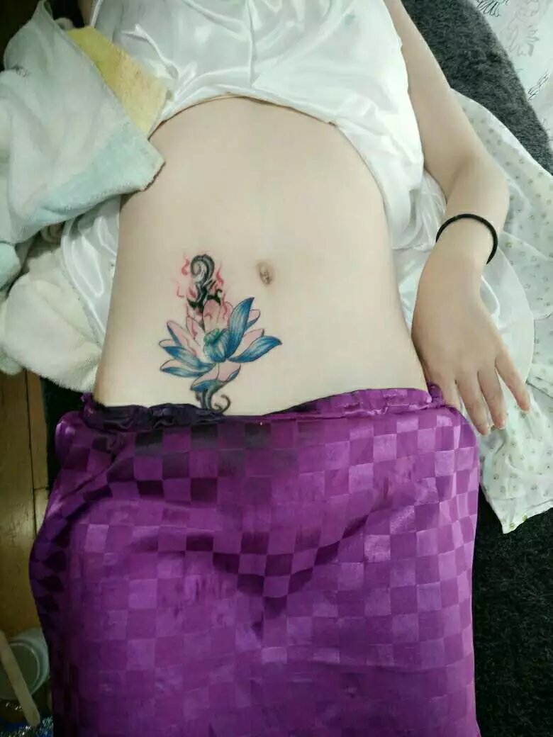 美女腹部疤痕莲花遮盖纹身-莲花纹身寓意与纹身讲究-武汉龙族纹身