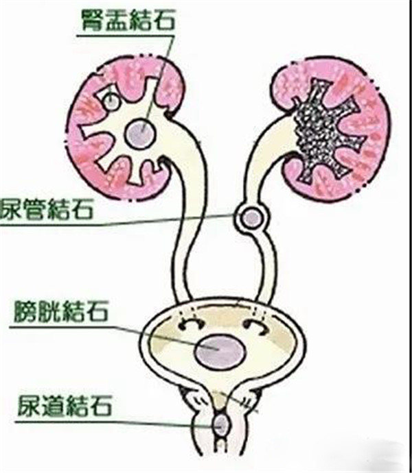 尿沉渣是什么意思图片